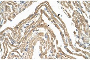 Human Muscle (CCBP2 antibody  (N-Term))