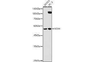 Western blot analysis of extracts of various cell lines, using SOX4 antibody (ABIN7270575) at 1:1000 dilution. (SOX4 antibody  (AA 1-100))