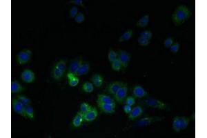 Immunofluorescent analysis of HepG2 cells using ABIN7158559 at dilution of 1:100 and Alexa Fluor 488-congugated AffiniPure Goat Anti-Rabbit IgG(H+L) (LDLRAD1 antibody  (AA 71-205))