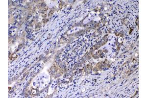 IHC analysis of Relaxin 1 using anti-Relaxin 1 antibody . (Relaxin 1 antibody)