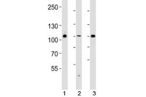 Western blot analysis of lysate from 293, HUVEC, T47D cell line (left to right) using GAB1 antibody diluted at 1:1000 for each lane. (GAB1 antibody  (AA 250-285))