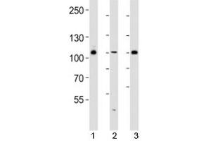 Western blot analysis of lysate from 293, HUVEC, T47D cell line (left to right) using GAB1 antibody diluted at 1:1000 for each lane.