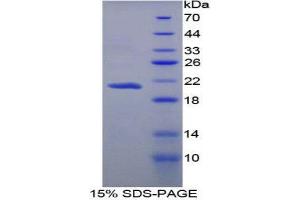 SDS-PAGE (SDS) image for Apolipoprotein B (APOB) protein (His tag) (ABIN1078868) (APOB Protein (His tag))