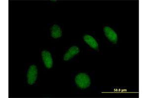Immunofluorescence of purified MaxPab antibody to PLEKHJ1 on HeLa cell. (GNRPX antibody  (AA 1-149))