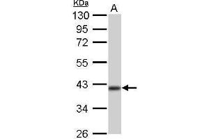 WB Image IDH3A antibody detects IDH3A protein by Western blot analysis. (IDH3A antibody)