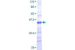 Coronin 1a Protein (AA 360-461) (GST tag)