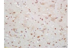 Formalin-fixed and paraffin embedded mouse brain labeled with Rabbit Anti-CIRBP Polyclonal Antibody, Unconjugated (ABIN872483) at 1:200 followed by conjugation to the secondary antibody and DAB staining (CIRBP antibody  (AA 61-172))