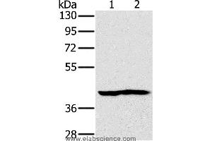 Western blot analysis of Mouse heart and kidney tissue, using NDUFA10 Polyclonal Antibody at dilution of 1:450