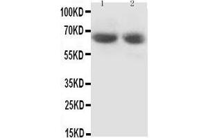 Anti-GAD65 antibody, Western blotting Lane 1: Rat Brain Tissue Lysate Lane 2: Rat Brain Tissue Lysate (GAD65 antibody  (N-Term))