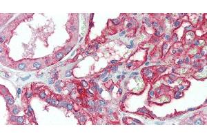 Immunohistochemistry of paraffin-embedded Kidney tissue using CD151 Polyclonal Antibody at dilution of 1:120. (CD151 antibody)