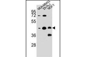 hCG_1645727 Antibody (C-term) (ABIN656073 and ABIN2845421) western blot analysis in MDA-M,ZR-75-1,MCF-7 cell line lysates (35 μg/lane). (KBTBD13 antibody  (C-Term))