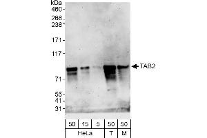anti-TGF-beta Activated Kinase 1/MAP3K7 Binding Protein 2 (TAB2) (AA 500-550) antibody