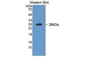 Detection of Recombinant Ninein, Human using Polyclonal Antibody to Ninein (NIN) (Ninein antibody  (AA 1-153))