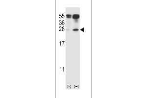 Western blot analysis of IL27 using rabbit polyclonal IL27 Antibody (C71) using 293 cell lysates (2 ug/lane) either nontransfected (Lane 1) or transiently transfected (Lane 2) with the IL27 gene. (IL-27 antibody  (AA 57-87))