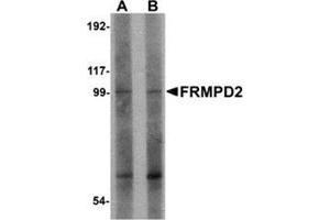 Western blot analysis of FRMPD2 in rat kidney tissue lysate with FRMPD2 antibody at (A) 1 and (B) 2 μg/ml. (FRMPD2 antibody  (N-Term))
