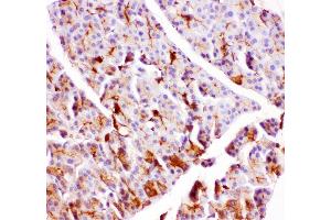 Anti- GPX1 antibody, IHC(P) IHC(P): Rat Pancreas Tissue (Glutathione Peroxidase 1 antibody  (Middle Region))