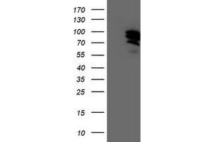 Western Blotting (WB) image for anti-General Transcription Factor IIF, Polypeptide 1, 74kDa (GTF2F1) antibody (ABIN1500596)