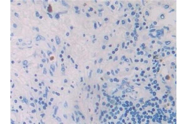 CCL26 antibody  (AA 24-94)