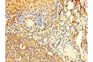 Immunohistochemistry of paraffin-embedded human tonsil tissue using ABIN7165002 at dilution of 1:100 (C20orf4 antibody  (AA 2-250))