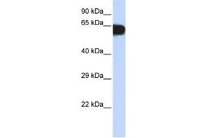 Western Blotting (WB) image for anti-T-Box 18 (TBX18) antibody (ABIN2458234) (T-Box 18 antibody)