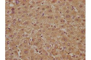 IHC image of ABIN7149404 diluted at 1:300 and staining in paraffin-embedded human liver tissue performed on a Leica BondTM system. (PLA2G4B antibody  (AA 514-781))
