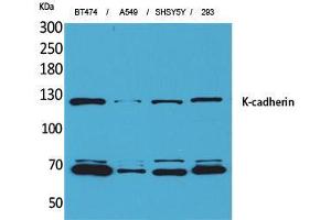 Western Blot (WB) analysis of BT474, A549, SHSY5Y, 293 cells using K-cadherin Polyclonal Antibody. (CDH6 antibody  (Internal Region))