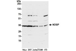 anti-Nitric Oxide Synthase Interacting Protein (NOSIP) (AA 251-301) antibody