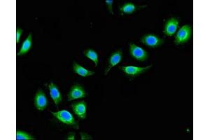 Immunofluorescent analysis of A549 cells using ABIN7149021 at dilution of 1:100 and Alexa Fluor 488-congugated AffiniPure Goat Anti-Rabbit IgG(H+L) (ATG4B antibody  (AA 350-400))