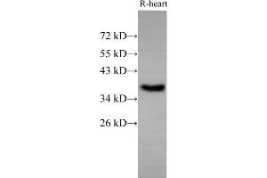 Western Blot analysis of Rat Heart using EpCAM Polyclonal Antibody at dilution of 1:500 (EpCAM antibody)