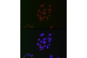 Immunofluorescence analysis of U-2 OS cells using CIRBP Rabbit mAb (ABIN7266452) at dilution of 1:100 (40x lens). (CIRBP antibody)