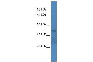Host: Rabbit Target Name: ARFGEF1 Sample Type: Fetal Liver lysates Antibody Dilution: 1.