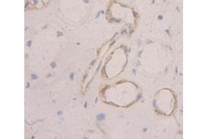 Figure. (PMP22 antibody  (AA 31-133))