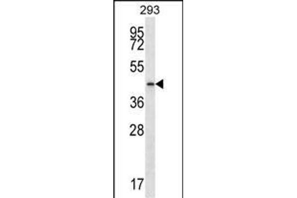 PTGR2 Antikörper  (N-Term)