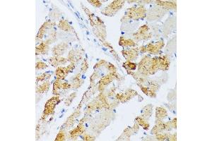 Immunohistochemistry of paraffin-embedded rat heart using WSB2 antibody (ABIN6133280, ABIN6150269, ABIN6150270 and ABIN6216800) at dilution of 1:100 (40x lens). (WSB2 antibody  (AA 1-200))
