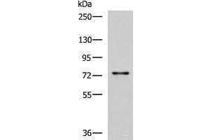 Western blot analysis of Rat liver tissue lysate using TGFBI Polyclonal Antibody at dilution of 1:850 (TGFBI antibody)