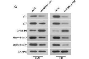 Inhibition of MBNL1-AS1 promoted the tumorigenesis of BC cells through the regulation of miR-135a/PHLPP2/FOXO1 in vivo. (Cyclin D1 antibody  (AA 96-295))