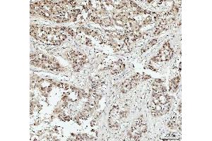 IHC analysis of DHX15/prp43 using anti-DHX15/prp43 antibody (ABIN7602738). (DHX15 antibody  (C-Term))