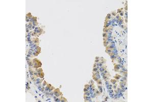 Immunohistochemistry of paraffin-embedded mouse lung using IL25 antibody (ABIN5974535) at dilution of 1/100 (40x lens). (IL-25 antibody)