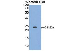 Western Blotting (WB) image for anti-Dishevelled Segment Polarity Protein 1 (DVL1) (AA 150-332) antibody (ABIN3202637) (DVL1 antibody  (AA 150-332))