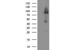 HEK293T cells were transfected with the pCMV6-ENTRY control (Left lane) or pCMV6-ENTRY FGFR2 (Right lane) cDNA for 48 hrs and lysed. (FGFR2 antibody)