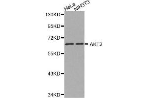 Western Blotting (WB) image for anti-V-Akt Murine Thymoma Viral Oncogene Homolog 2 (AKT2) antibody (ABIN3020945) (AKT2 antibody)