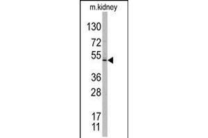 Western blot analysis of TASP1 C-term polyclonal antibody in mouse kidney tissue lysates.