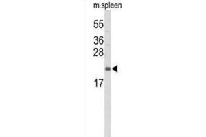 Western Blotting (WB) image for anti-Interleukin 31 (IL31) antibody (ABIN3004157) (IL-31 antibody)
