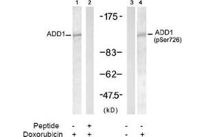 Image no. 2 for anti-Adducin 1 (Alpha) (ADD1) (pSer726) antibody (ABIN196918) (alpha Adducin antibody  (pSer726))