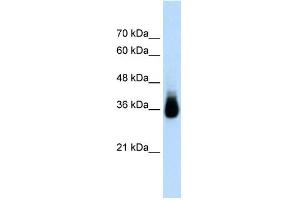 WB Suggested Anti-HOXC9 Antibody Titration:  2. (HOXC9 antibody  (N-Term))