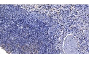 Detection of FASL in Human Spleen Tissue using Polyclonal Antibody to Factor Related Apoptosis Ligand (FASL) (FASL antibody  (AA 102-280))