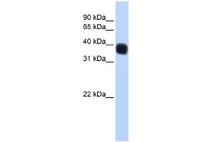 WB Suggested Anti-SSBP3 Antibody Titration: 0. (SSBP3 antibody  (Middle Region))