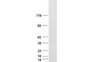 Solute Carrier Family 35, Member A4 (SLC35A4) protein (Myc-DYKDDDDK Tag)