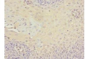 Immunohistochemistry of paraffin-embedded human tonsil tissue using ABIN7165801 at dilution of 1:100 (SRF antibody  (AA 616-875))