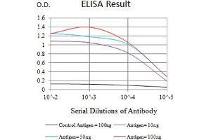 Black line: Control Antigen (100 ng),Purple line: Antigen (10 ng), Blue line: Antigen (50 ng), Red line:Antigen (100 ng) (DcR2 antibody  (AA 56-211))